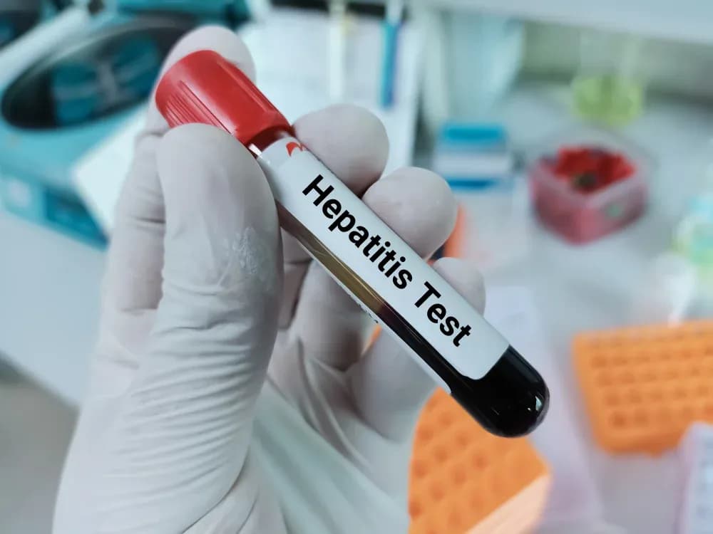 Govt Launches Hepatitis Screening Programme for Islamabad Employees
